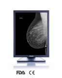 Ce FDA Approved LCD Displays for Mammography Imaging